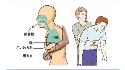 安全生產(chǎn)月科普學習（一）| 急救知識小貼士